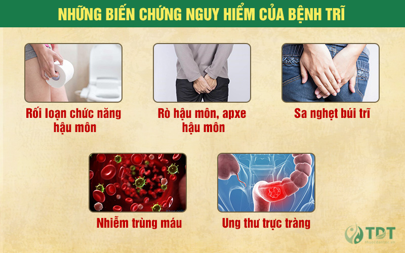 Biến chứng nguy hiểm của bệnh trĩ