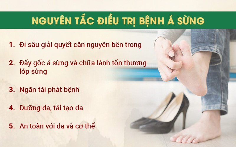 Nguyên tắc trong điều trị bệnh á sừng