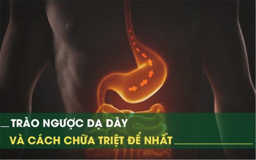 Trào ngược dạ dày