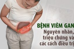 bệnh viêm gan