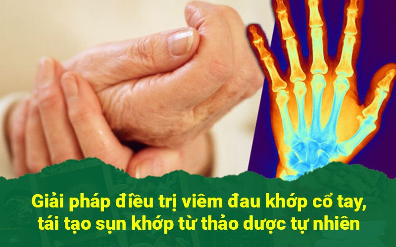 Viêm đau khớp cổ tay và cách điều trị từ thảo dược đẩy lùi đau nhức