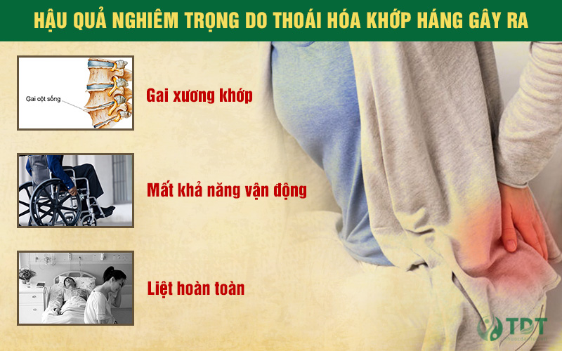 thoái hóa khớp háng