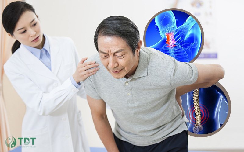 Triệu chứng vôi hoá cột sống 