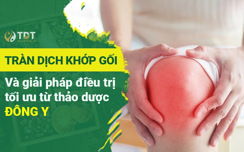 Tràn dịch khớp gối và giải pháp điều tối ưu từ thảo dược Đông y