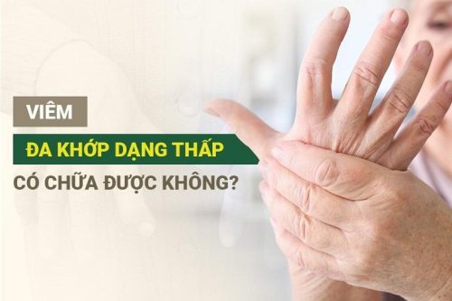 viêm khớp dạng thấp có chữa được không