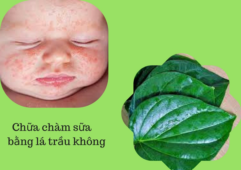 Chữa chàm sữa bằng lá trầu không