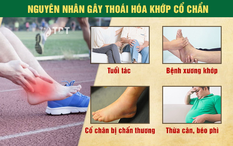 nguyên nhân gây thoái hóa cổ chân