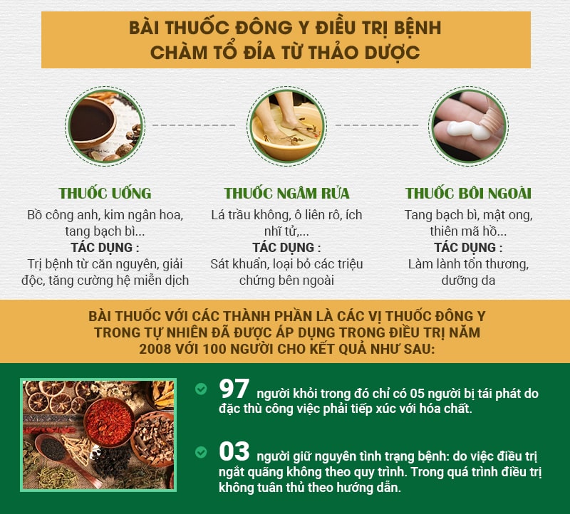  điều trị chàm tổ đỉa bằng thảo dược