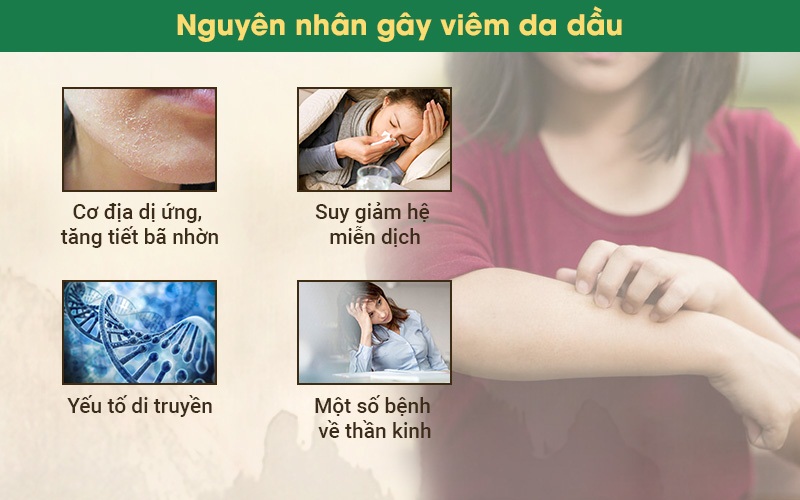 Nguyên nhân gây viêm da tiết bã 