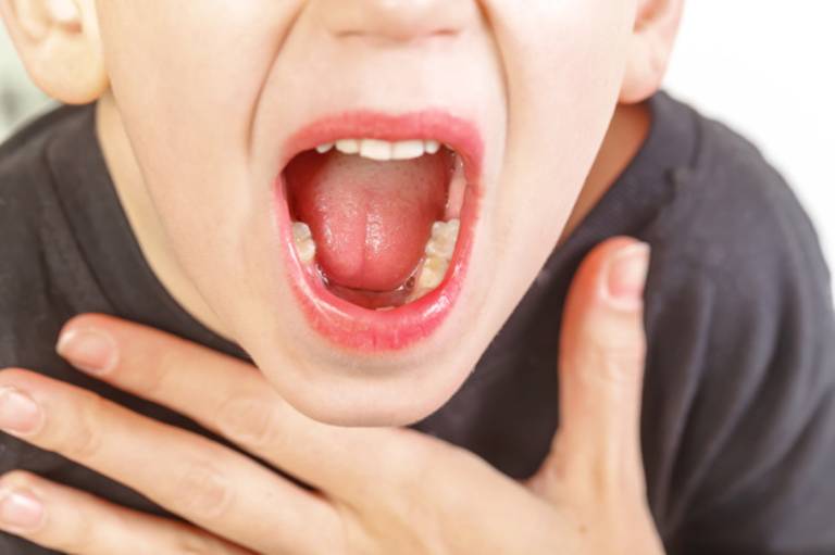 Người bệnh thường có cảm giác cổ họng đau rát nặng và khó nuốt thức ăn