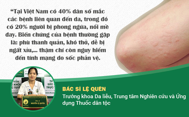 Chuyên gia nêu số liệu đáng báo động về tình trạng phong ngứa ở Việt Nam.