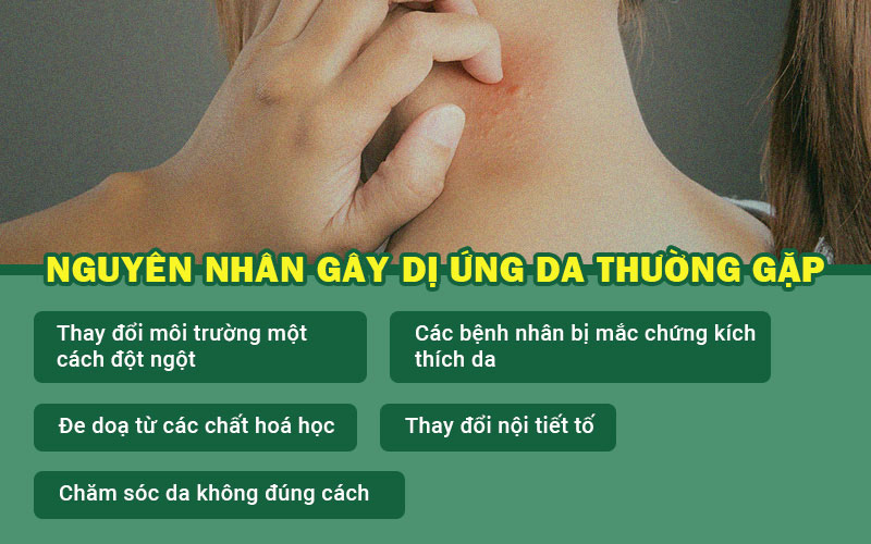 Những nguyên nhân gây dị ứng da phổ biến. 