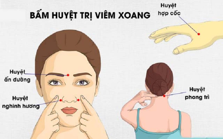 Cách bấm huyệt chữa viêm xoang chuẩn khoa học