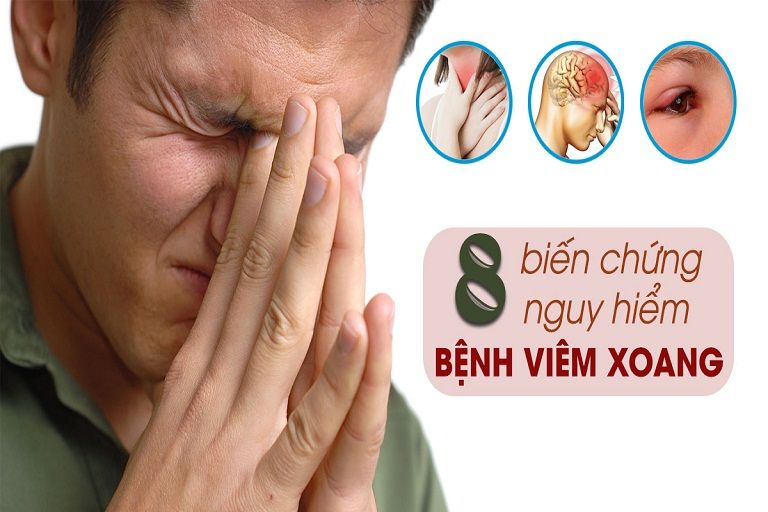 biến chứng của Viêm xoang