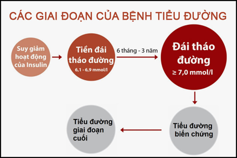 Bệnh tiểu đường type 2 chia thành 4 giai đoạn