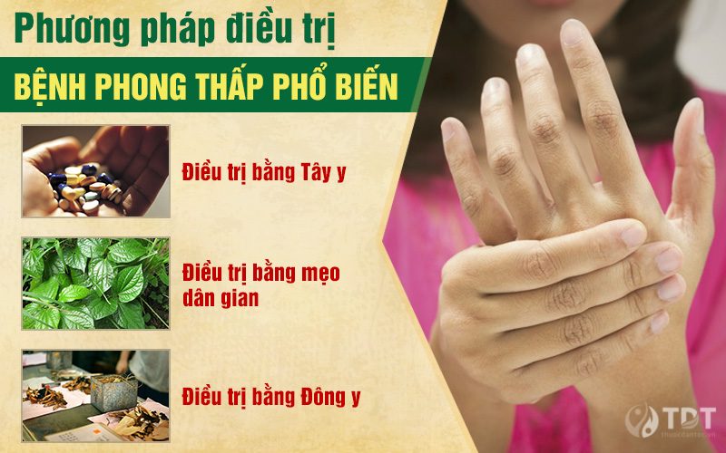 Phương pháp điều trị bệnh phong thấp