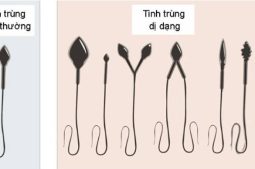 Cách nhận biết tinh trùng khỏe mạnh hay không qua hình dạng