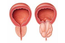 Hình ảnh nang tuyến tiền liệt