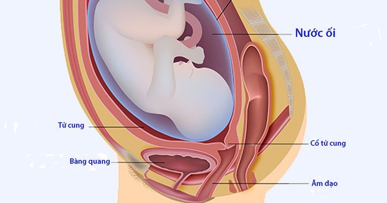 Nguyên nhân chính khiến bà bầu bị bí tiểu là bàng quang bị chèn ép