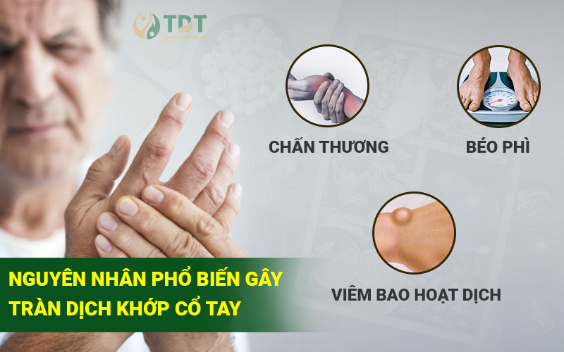 Nguyên nhân gây bệnh tràn dịch khớp cổ tay