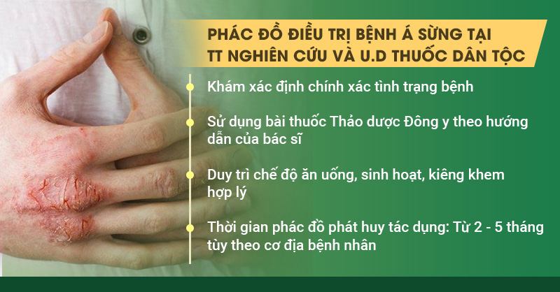 điều trị á sừng tay, chân, mặt tại Trung tâm Nghiên cứu và Ứng dụng TDT