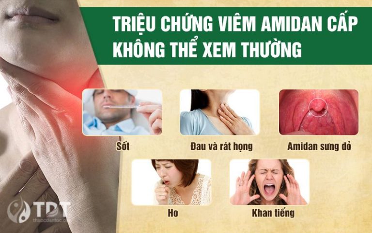 Biểu hiện viêm amidan cấp tính