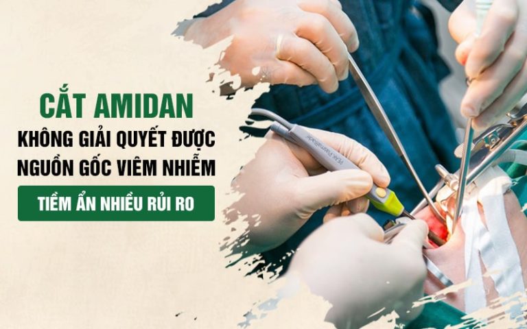 Phẫu thuật không phải là giải pháp tối ưu cho viêm amidan mãn tính