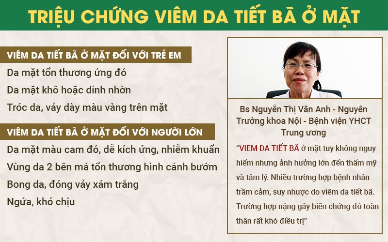 dấu hiệu viêm da tiết bã ở mặt