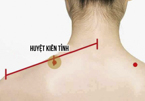 Điều trị bệnh viêm khớp vai theo y học cổ truyền bằng phương pháp bấm huyệt