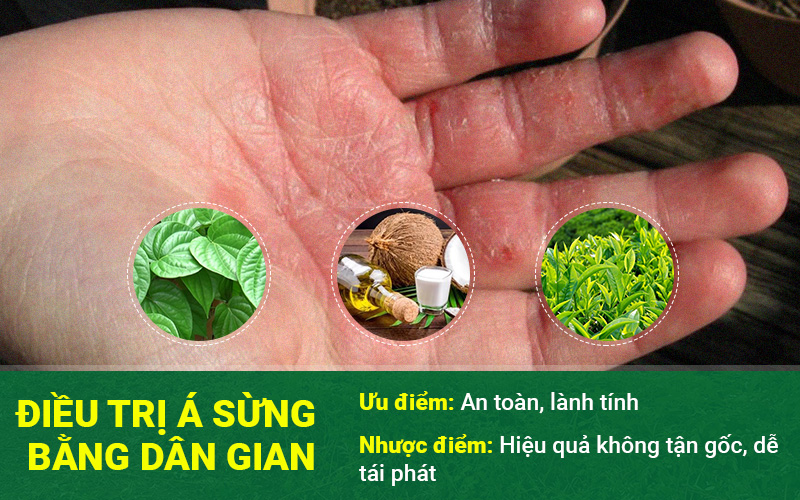 Cách chữa bệnh á sừng bằng thuốc dân gian