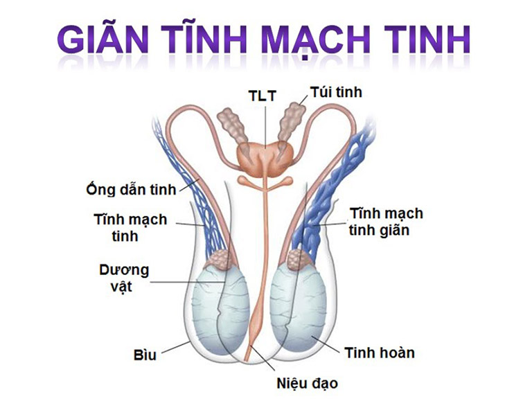 đau một bên tinh hoàn