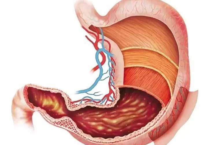 hang vị dạ dày nằm ở vị trí nào