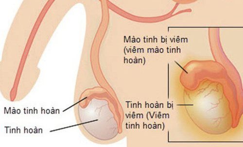 mào tinh hoàn là gì