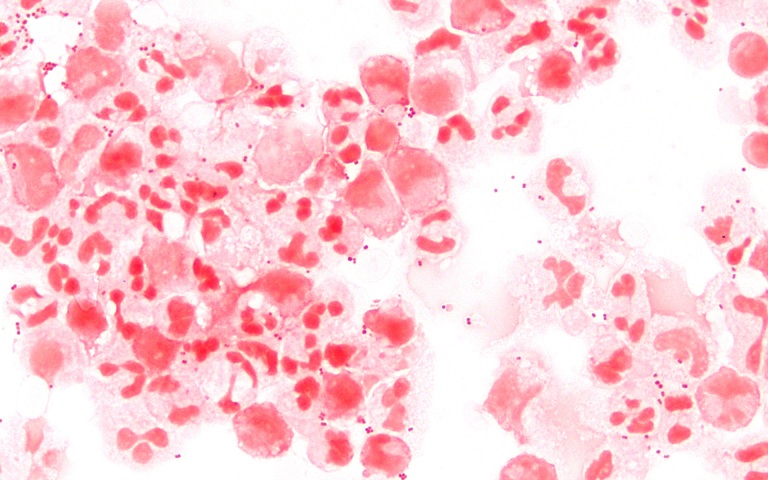 Neisseria gonorrhoeae là gì