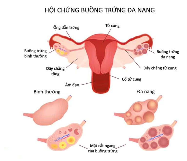 Các bệnh phụ khoa