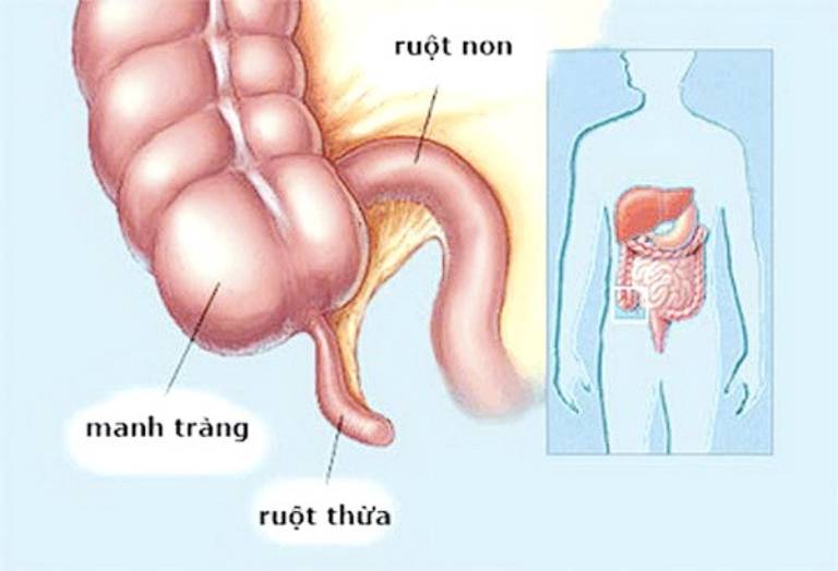 Ruột thừa là gì?