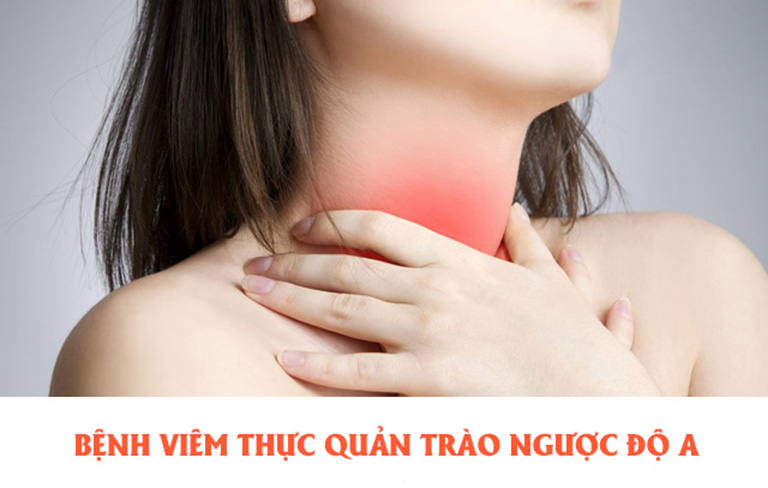 viêm thực quản trào ngược độ a