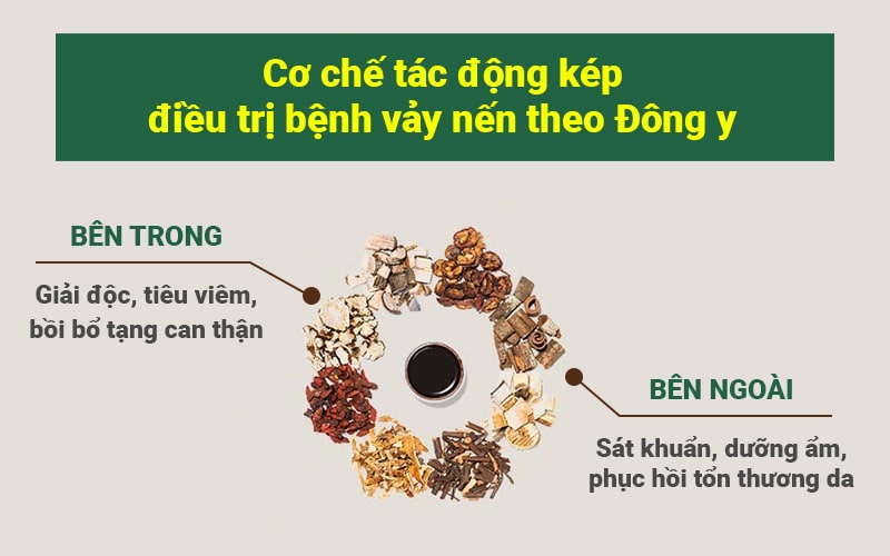 Nguyên tắc điều trị vảy nến bằng thuốc nam của Trung Tâm Thuốc Dân Tộc