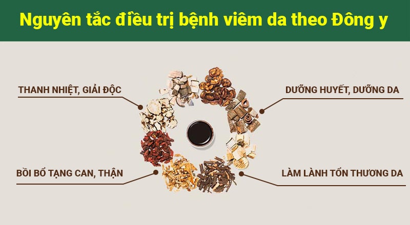 Bài thuốc Thanh bì dưỡng can thang đặc trị các bệnh viêm da hiệu quả