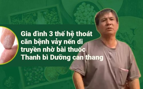 Gia đình 3 thế hệ thoát căn bệnh vảy nến di truyền nhờ bài thuốc Thanh bì Dưỡng can thang