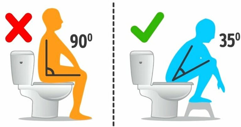 tư thế ngồi đúng khi đi vệ sinh phải tạo thành góc 35 độ