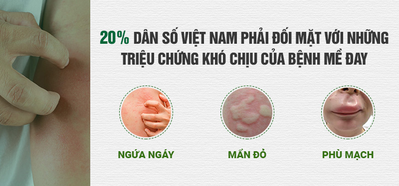 triệu chứng mề đay mẩn ngứa