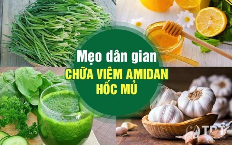 viêm amidan hốc mủ kiêng ăn gì