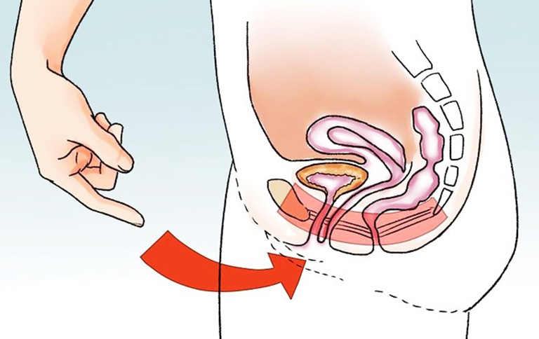 các vấn đề về phóng tinh