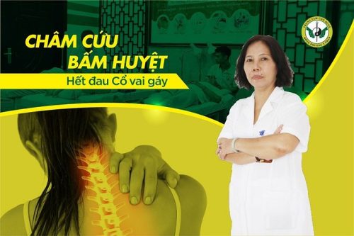 châm cứ đau vai gáy