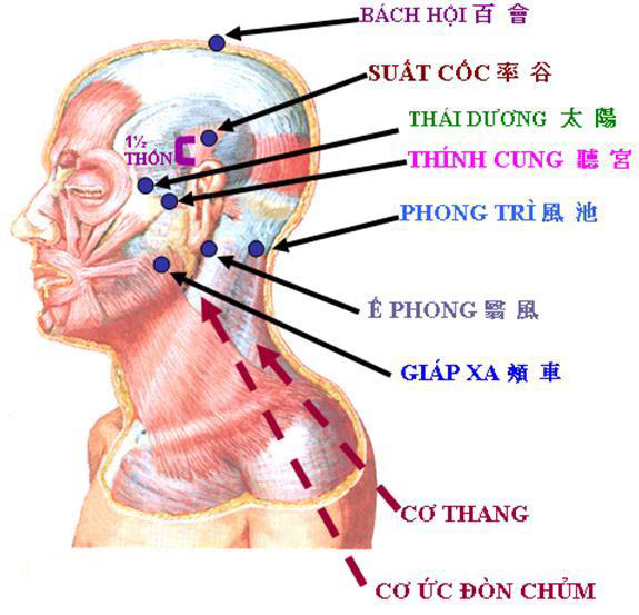 Tùy vào tình trạng bệnh cụ thể bác sĩ sẽ đưa ra phác đồ châm cứu phù hợp