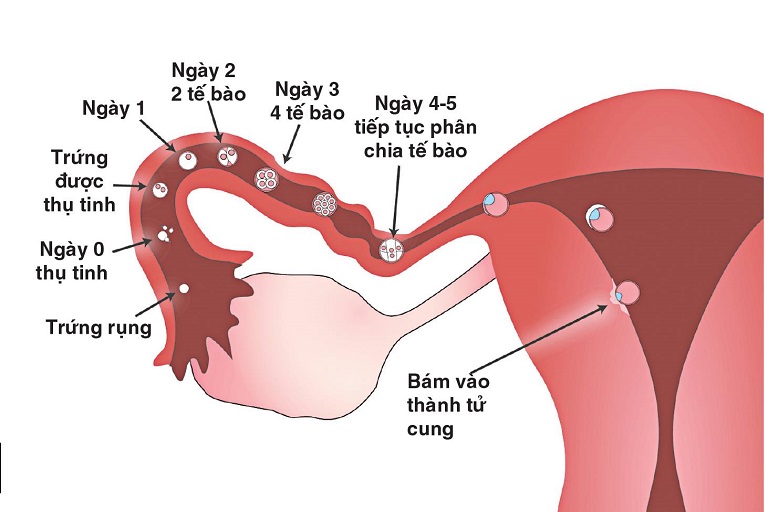 tuổi thọ của người cắt tử cung và buồng trứng