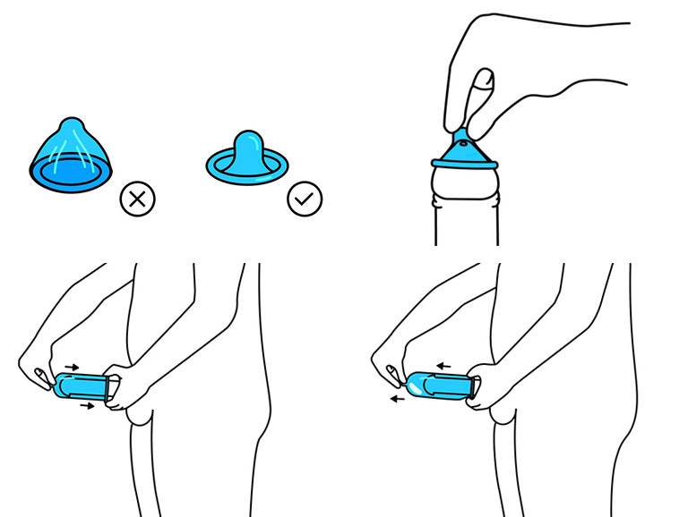 cách sử dụng bao cao su Innova