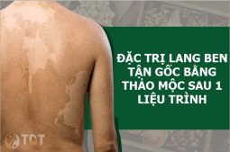 Bài thuốc đặc trị lang ben