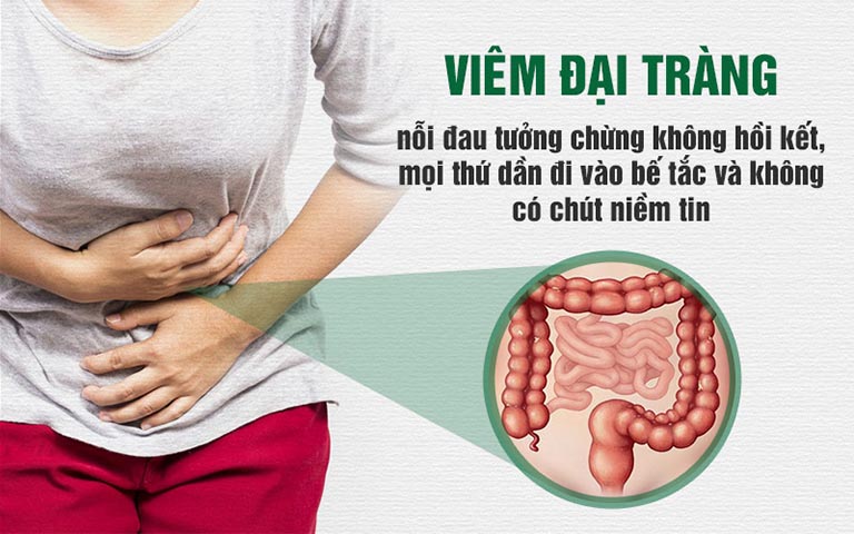 Nỗi đau ám ảnh căn bệnh viêm đại tràng